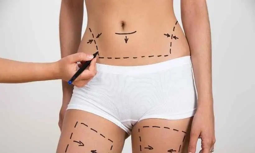 tratamento com Hidrolipo não aspirativa