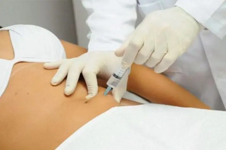 tratamento com hidrolipo não aspirativa